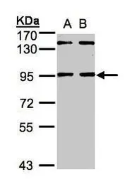 Anti-NRIP antibody used in Western Blot (WB). GTX105954