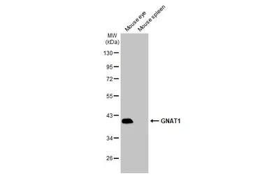 Anti-GNAT1 antibody [N1C3] used in Western Blot (WB). GTX105960