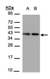 Anti-TBCC antibody [N1C3] used in Western Blot (WB). GTX105962