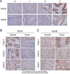 Anti-Monoamine Oxidase B antibody [N2C3] used in IHC (Paraffin sections) (IHC-P). GTX105970