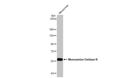 Anti-Monoamine Oxidase B antibody [N2C3] used in Western Blot (WB). GTX105970
