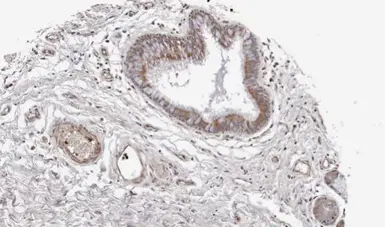 Anti-Wnt11 antibody used in IHC (Paraffin sections) (IHC-P). GTX105971