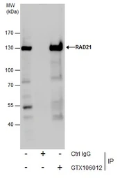 Anti-Rad21 antibody used in Immunoprecipitation (IP). GTX106012