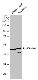 Anti-CaMKIV antibody [N1C3] used in Western Blot (WB). GTX106023