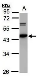 Anti-CaMKIV antibody [N1C3] used in Western Blot (WB). GTX106023