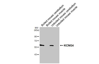 Anti-KCNG4 antibody used in Western Blot (WB). GTX106058