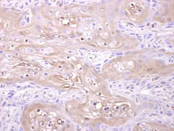 Anti-Adenylate kinase 1 antibody [N1C3] used in IHC (Paraffin sections) (IHC-P). GTX106079