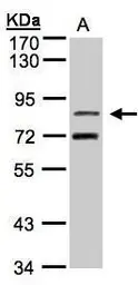 Anti-TLE2 antibody [C2C3], C-term used in Western Blot (WB). GTX106107