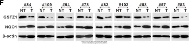 Anti-GSTZ1 antibody [N1C3] used in Western Blot (WB). GTX106109