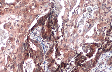 Anti-SIAT4A antibody used in IHC (Paraffin sections) (IHC-P). GTX106121