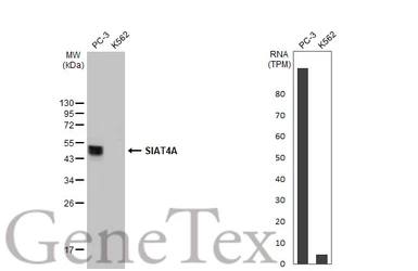 Anti-SIAT4A antibody used in Western Blot (WB). GTX106121