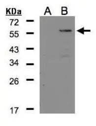 Anti-Carboxypeptidase E antibody [N2C2], Internal used in Western Blot (WB). GTX106177