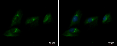 Anti-Autotaxin antibody used in Immunocytochemistry/ Immunofluorescence (ICC/IF). GTX106209