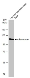 Anti-Autotaxin antibody used in Western Blot (WB). GTX106209