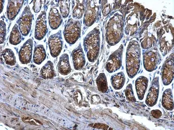 Anti-CD2AP antibody used in IHC (Paraffin sections) (IHC-P). GTX106235
