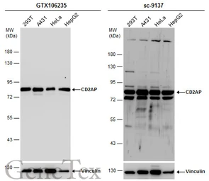 Anti-CD2AP antibody used in Western Blot (WB). GTX106235