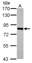 Anti-CD2AP antibody used in Western Blot (WB). GTX106235