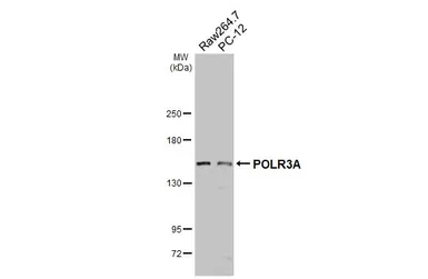 Anti-POLR3A antibody used in Western Blot (WB). GTX106241