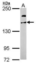 Anti-USP47 antibody used in Western Blot (WB). GTX106253