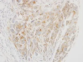 Anti-VPS26 antibody [C2C3], C-term used in IHC (Paraffin sections) (IHC-P). GTX106297