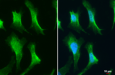 Anti-VPS26 antibody [C2C3], C-term used in Immunocytochemistry/ Immunofluorescence (ICC/IF). GTX106297