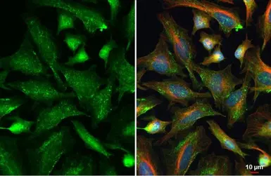 Anti-VPS26 antibody [C2C3], C-term used in Immunocytochemistry/ Immunofluorescence (ICC/IF). GTX106297