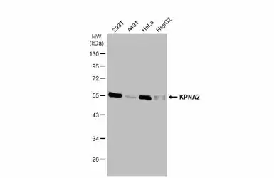 Anti-KPNA2 antibody [C3], C-term used in Western Blot (WB). GTX106323