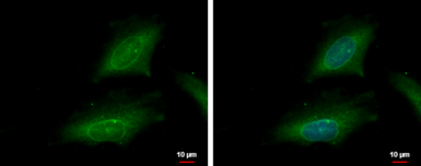 Anti-KPNA2 antibody [C3], C-term used in Immunocytochemistry/ Immunofluorescence (ICC/IF). GTX106323