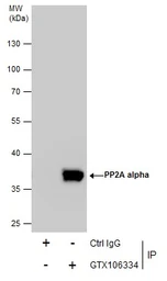 Anti-PP2A alpha antibody used in Immunoprecipitation (IP). GTX106334
