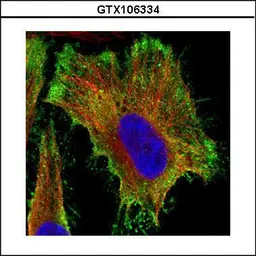 Anti-PP2A alpha antibody used in Immunocytochemistry/ Immunofluorescence (ICC/IF). GTX106334