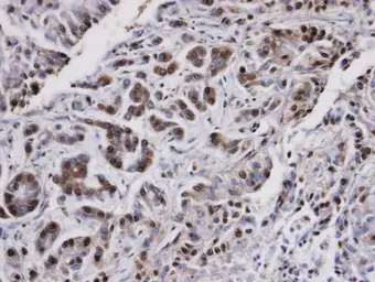 Anti-PP2A alpha antibody used in IHC (Paraffin sections) (IHC-P). GTX106334