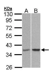 Anti-PP2A alpha antibody used in Western Blot (WB). GTX106334