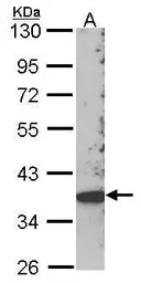 Anti-SCAP2 antibody [C2C3], C-term used in Western Blot (WB). GTX106357