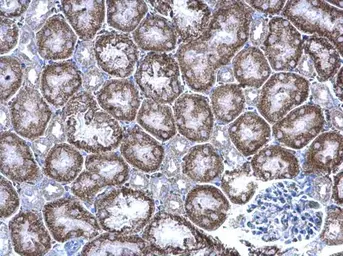 Anti-GIPC1 antibody used in IHC (Paraffin sections) (IHC-P). GTX106382