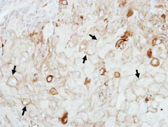 Anti-GIPC1 antibody used in IHC (Paraffin sections) (IHC-P). GTX106382