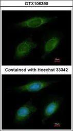 Anti-RNF6 antibody [C3], C-term used in Immunocytochemistry/ Immunofluorescence (ICC/IF). GTX106390