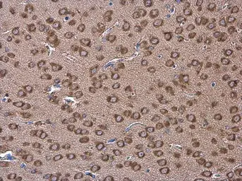Anti-Coronin 1A antibody [C3], C-term used in IHC (Paraffin sections) (IHC-P). GTX106424
