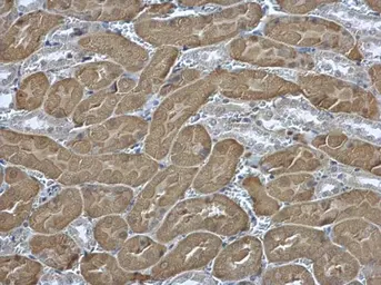 Anti-EIF2 beta antibody used in IHC (Paraffin sections) (IHC-P). GTX106484