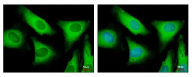 Anti-EIF2 beta antibody used in Immunocytochemistry/ Immunofluorescence (ICC/IF). GTX106484