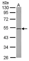 Anti-EIF2 beta antibody used in Western Blot (WB). GTX106484