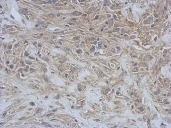 Anti-RAP1GDS1 antibody [N1N2], N-term used in IHC (Paraffin sections) (IHC-P). GTX106506