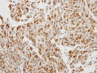 Anti-EEF1B2 antibody [N1C3] used in IHC (Paraffin sections) (IHC-P). GTX106535