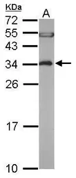 Anti-EEF1B2 antibody [N1C3] used in Western Blot (WB). GTX106535