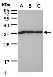 Anti-EEF1B2 antibody [N1C3] used in Western Blot (WB). GTX106535