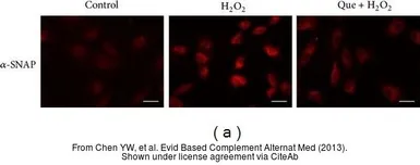 Anti-alpha SNAP antibody [N2C3] used in Immunocytochemistry/ Immunofluorescence (ICC/IF). GTX106626