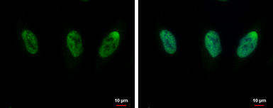 Anti-CIP29 antibody [N1C3] used in Immunocytochemistry/ Immunofluorescence (ICC/IF). GTX106633