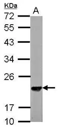 Anti-SKP1 antibody used in Western Blot (WB). GTX106675