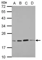 Anti-SKP1 antibody used in Western Blot (WB). GTX106675