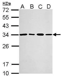 Anti-PSME3 antibody used in Western Blot (WB). GTX106722
