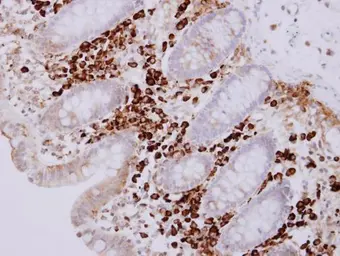 Anti-MZB1?antibody used in IHC (Paraffin sections) (IHC-P). GTX106794